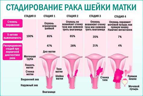 Признаки сокращения шейки матки