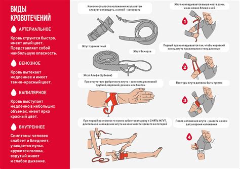 Применение жгута Эсмарха в медицине