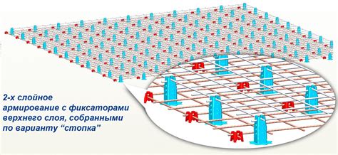 Примеры успешного использования рамповых фиксаторов