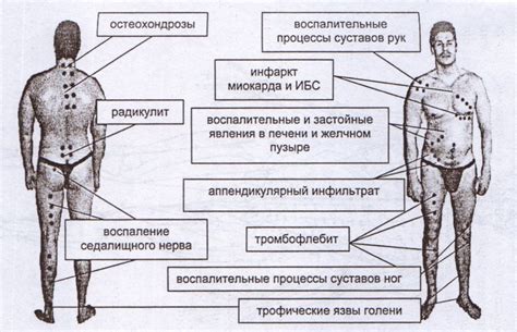 Принципы работы пиявки при гирудотерапии