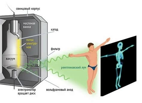 Принципы работы рентгеновского аппарата: излучение и детектирование