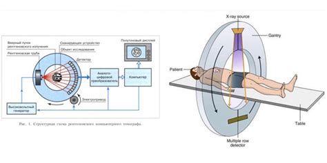 Принцип работы КТ томографа