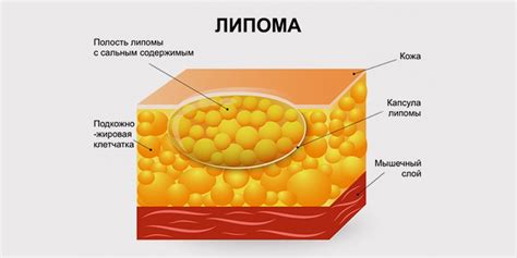 Причины жировика