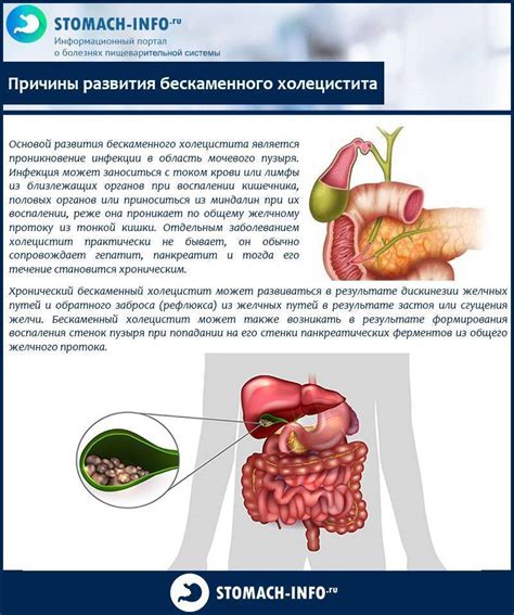 Причины застоя желчи