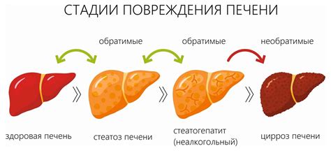 Причины и факторы риска развития цирроза печени