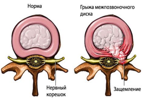 Причины повреждения диска и их последствия