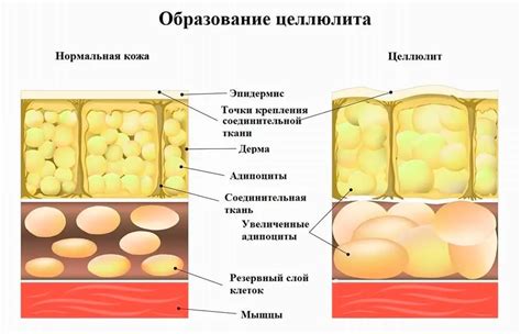 Причины появления нежелательной выпуклости