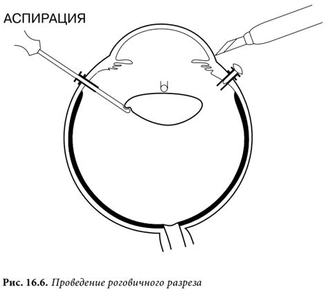 Проведение разреза