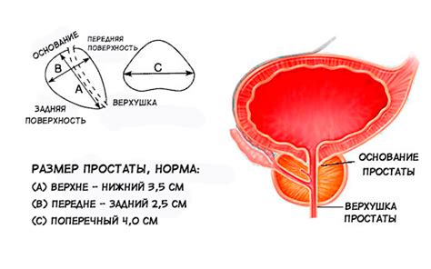 Проверка предстательной железы у мужчин