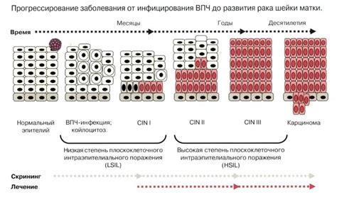 Прогрессирование ВПЧ