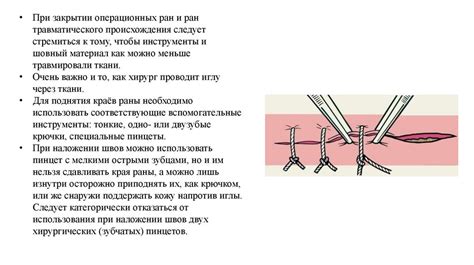 Процедура наложения шва: