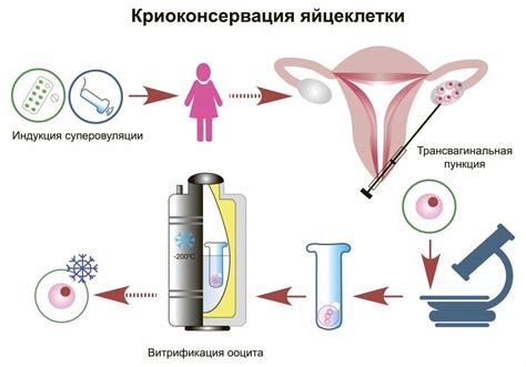 Процедура сохранения яйцеклеток