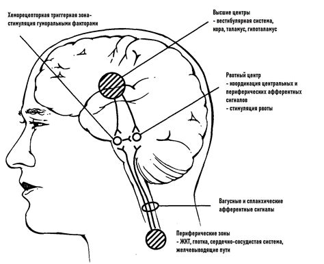 Рвотный центр: причины и избавление