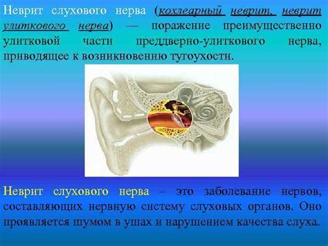 Роль слухового нерва