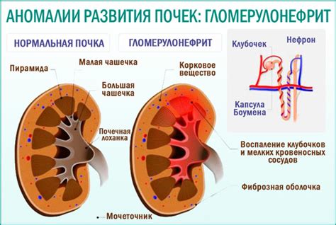 Симптомы аномалии редукс