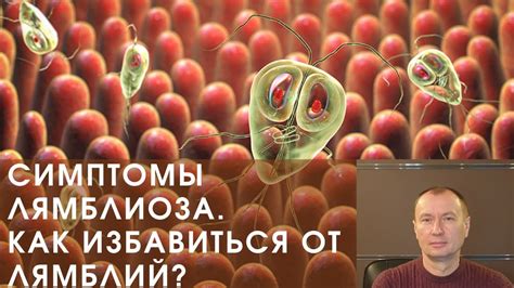 Симптомы лямблиоза: как определить заражение