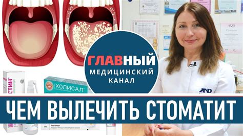 Советы по профилактике стоматита у взрослых