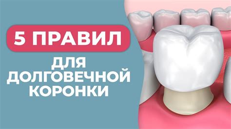 Срок службы коронки Леорика и уход за ней