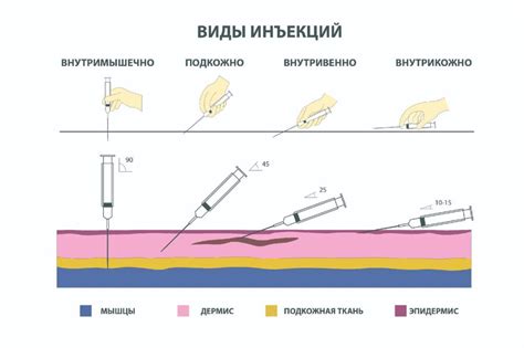 Техника выполнения инъекции гептрала