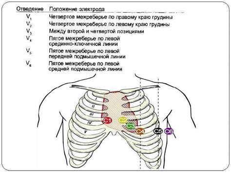 Техника проведения ЭКГ в домашних условиях