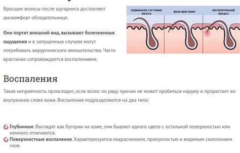 Убираем вросшие волосы: эффективные методы после шугаринга