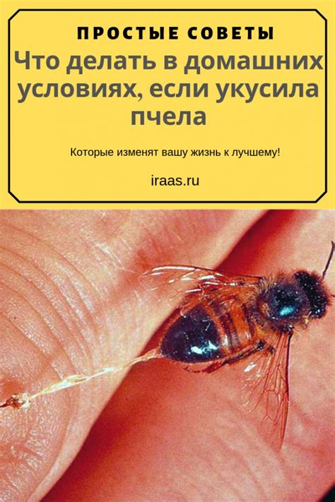 Укус пчелы у ребенка: как помочь первой помощью