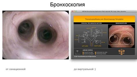 Установка приложения для работы с эндоскопом