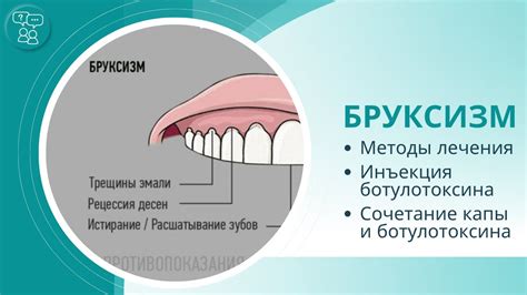 Физиотерапевтические методы лечения бруксизма