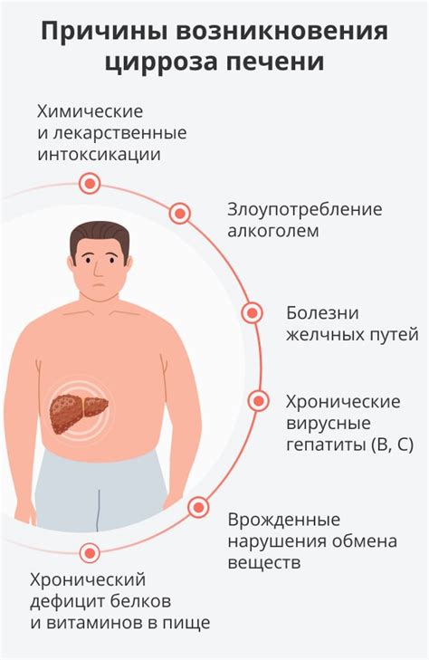 Физические признаки цирроза печени