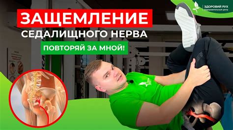 Физические упражнения для устранения защемления нерва