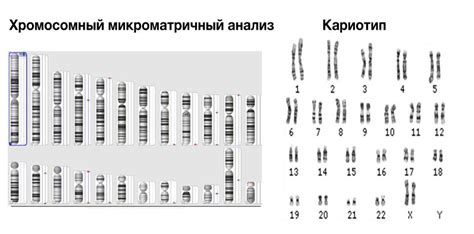 Хромосомный анализ