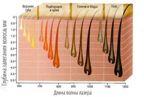 Частота лазерной эпиляции для разных зон тела