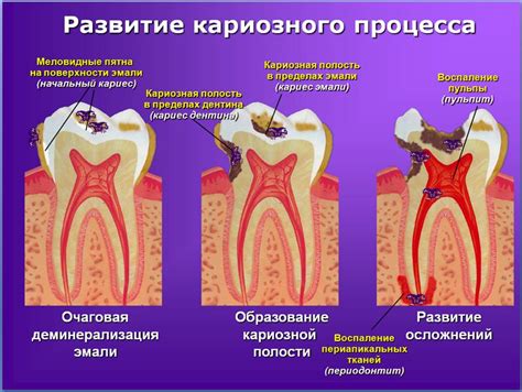 Что может происходить при неполном удалении Нвидиа Инспектора