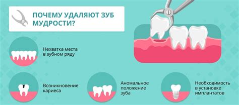 Что нужно знать о процедуре удаления кутикулы