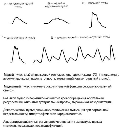 Что такое пульс на сонной?