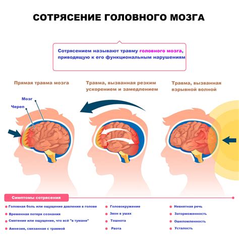 Что такое сотрясение мозга?