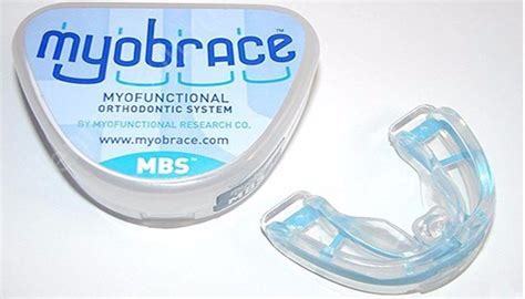 Что такое Myobrace?