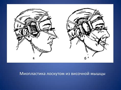 Шаг 4: Нанесение мускулатуры