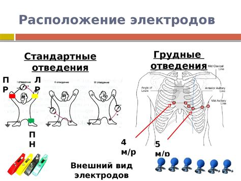 Электроды: куда они накладываются?