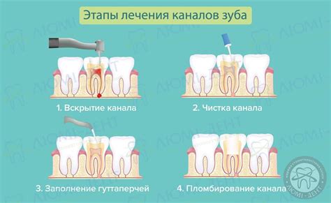 Этапы корректной чистки после приготовления